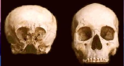 cranios 14