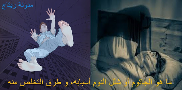 ما هو جاثوم النوم أو شلل النوم،  أسبابه و طرق للتخلص منه