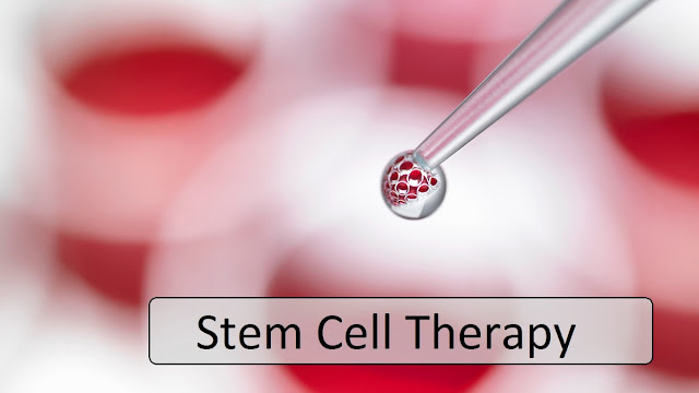 Stem Cell Therapy