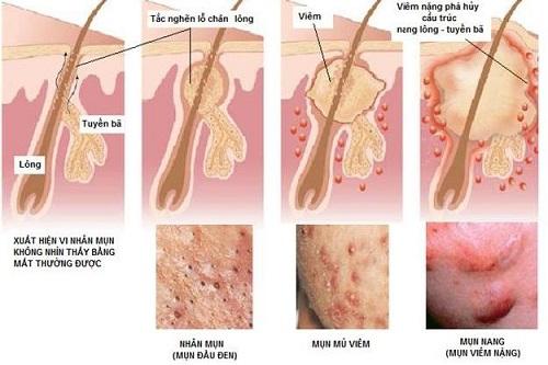 Phương thuốc chữa bệnh ngoài da tại chỗ