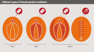 Female Genital Mutilation