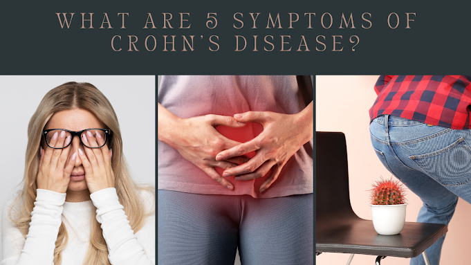 symptoms of Crohn's disease