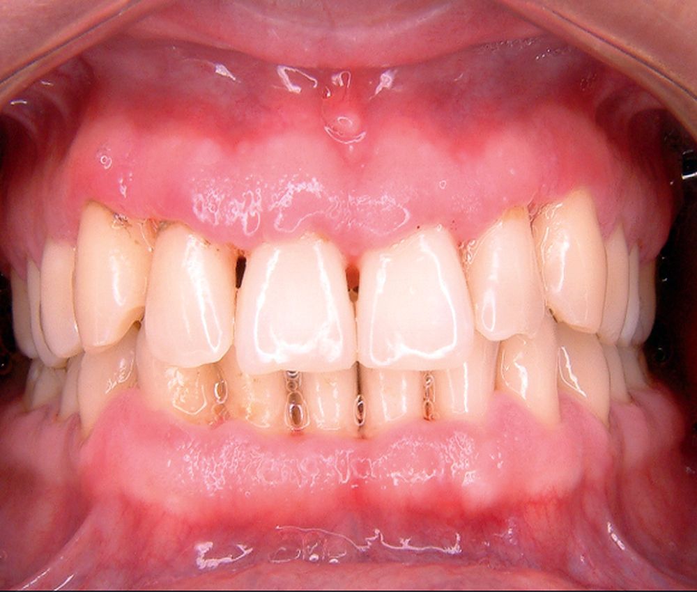 Periodoncia