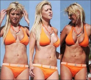 tara reid plastic surgery