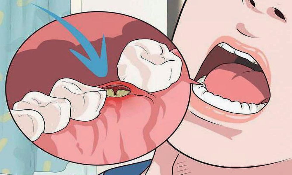 Oral Surgery