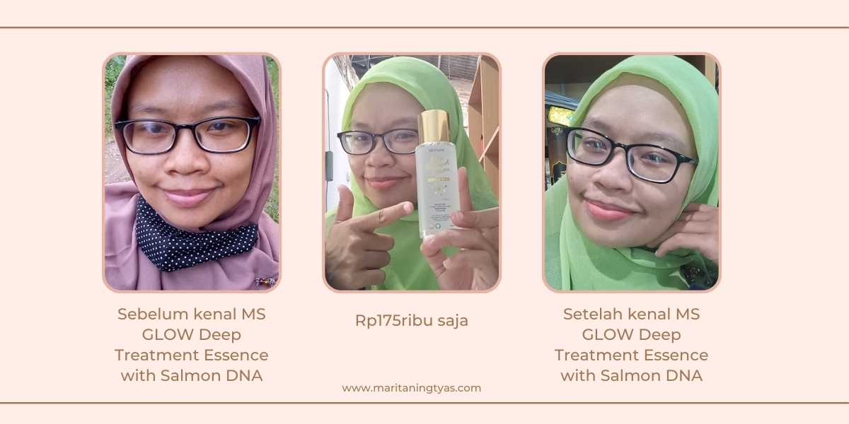 before after MS GLOW DTE with Salmon DNA