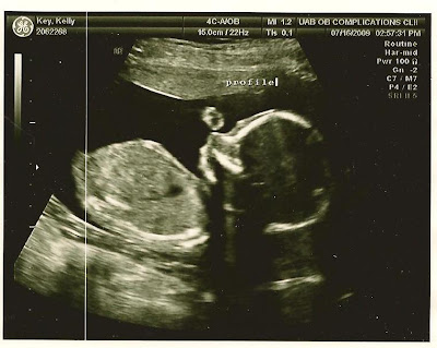 3d ultrasound 20 weeks pregnant. 3d ultrasound 20 weeks boy.