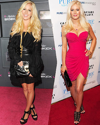 heidi montag before and after people. images Heidi Montag and Spencer Pratt heidi montag before and after people.