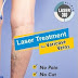 Everything You Must Know About Laser Treatment for Varicose Veins