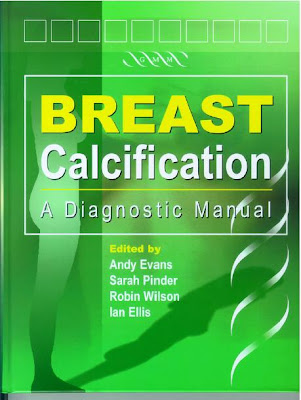 BREAST Calcification : A Diagnostic Manual