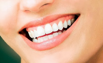 10 Top Tips For Caring For Your Teeth