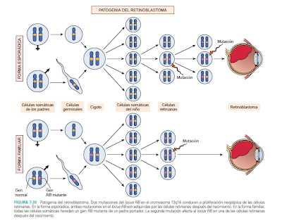 Resultado de imagen para genetica del retinoblastoma