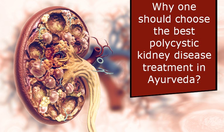 Why one should choose the best polycystic kidney disease treatment in Ayurveda?