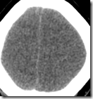 PSEUDO SAH_1.CT.3.92.2011.06.29.10.45.48.546875.34610733