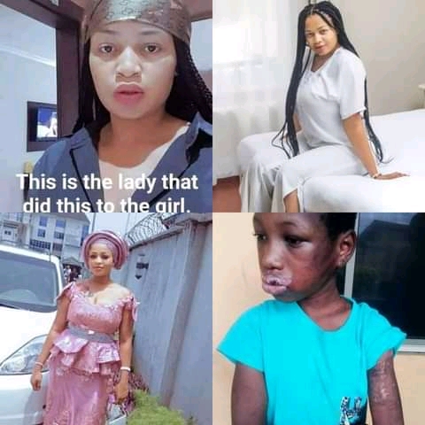 Photos: Heartless woman poured hot water mixed with pepper on 10 years old maid 