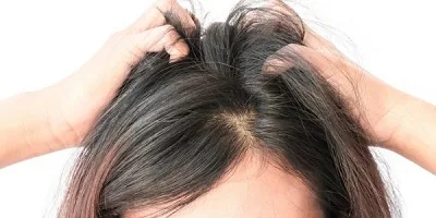 how to hair transplant for women