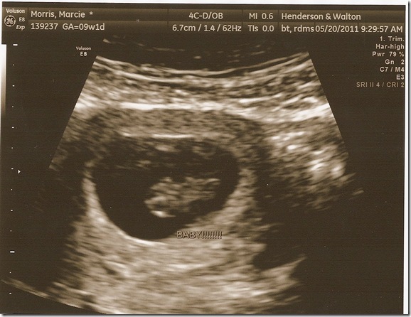 8 weeks 3 days1