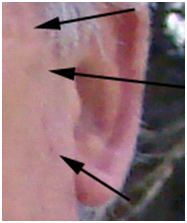 Spot Healing Example