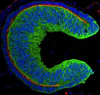  sel punca yang berasal dari insan sanggup secara impulsif membentuk jaringan yang berkemba Pintar Pelajaran Terapi Stem Cell / Sel Punca, Harapan Baru Tuna Netra