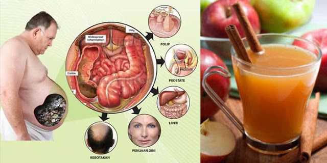 LUAR BIASA!!! Minuman Ini Berkhasiat Membersihkan Pencernaan, Membakar Lemak Dan Mengeluarkan Racun Dalam Tubuh