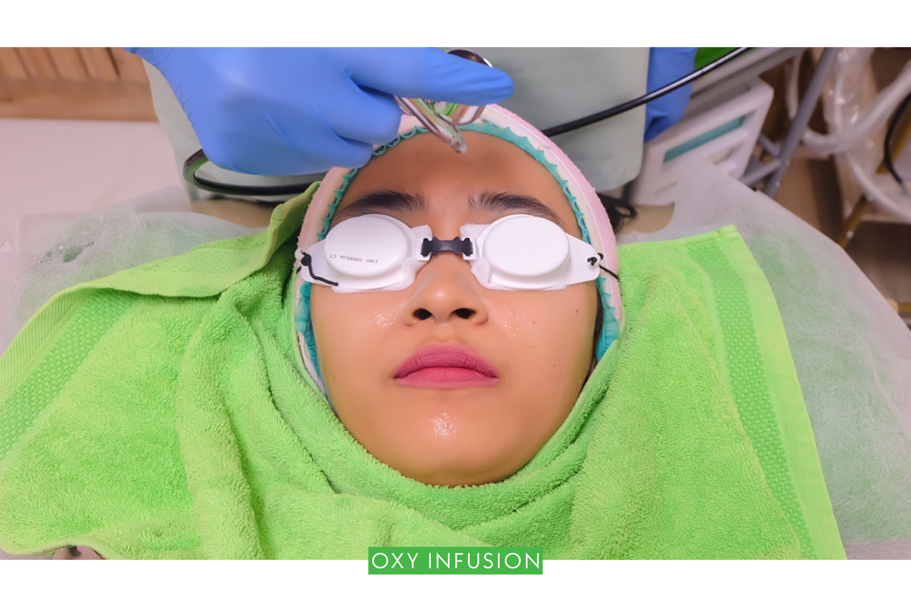 [Review] Treatment DNA Salmon Micro Injection di ZAP Clinic