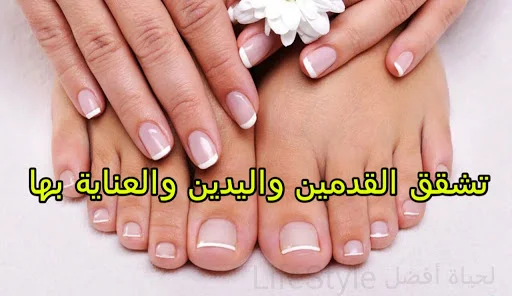 أسباب تشقق القدمين واليدين وطرق العناية بها