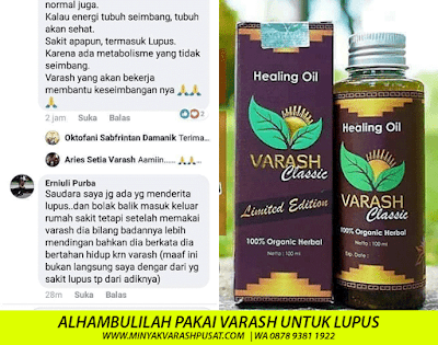 Manfaat Minyak Varash untuk Lupus