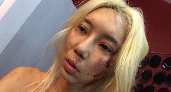 Leng Yein, DJ Terkenal Malaysia Kongsi Detik Hitam Jadi Mangsa Pukul Boyfriend Psycho