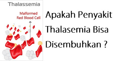 Apakah Penyakit Thalasemia Bisa Disembuhkan ?