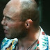 Accurate Portrayal of Cauliflower Ear in "The Expendables"