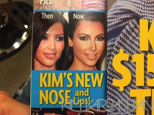 kim kardashian plastic surgery before after. Kim Kardashian : Avant et