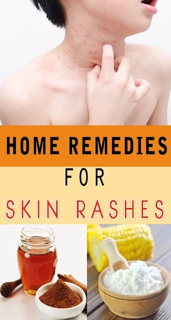 How to Get Rid of a Rash Fast and Naturally At Home
