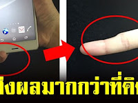 เตือนก่อนสาย อาการนิ้วก้อยผิดรูป เพราะถือสมาร์ทโฟน ส่งผลมากกว่าที่คิด