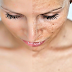 Melasma Treatment For Dark Skin in Dubai, Abu Dhabi & Sharjah