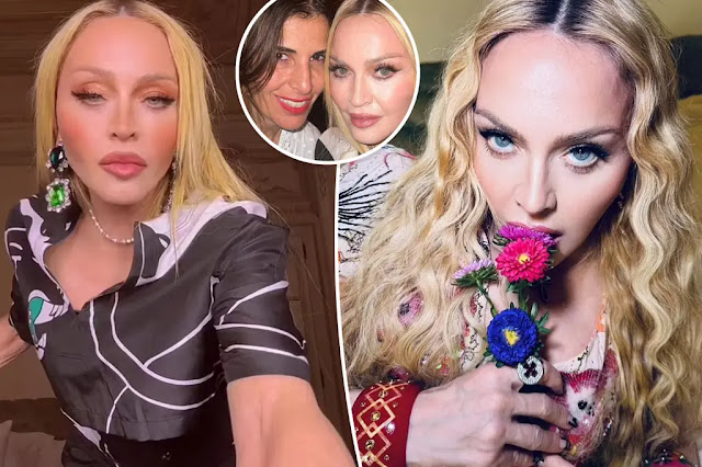 Is Madonna Still Beautiful at 65? Discover Her Ageless Charm Is Madonna Still Beautiful at 65? Discover Her Ageless Charm