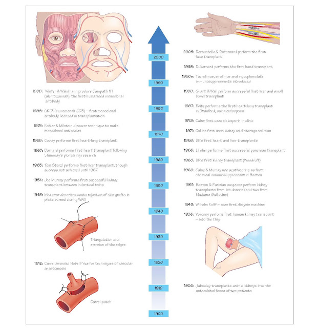 History Of Transplantation, Vascular anastom ses, Source of organs, Where to place the kidney, Early transplants, Development of immunosuppression, Non-renal organ transplants