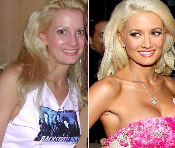 hollymadisonbeforeafter%255B1%255D Hollywood Celebs Before & After Surgery