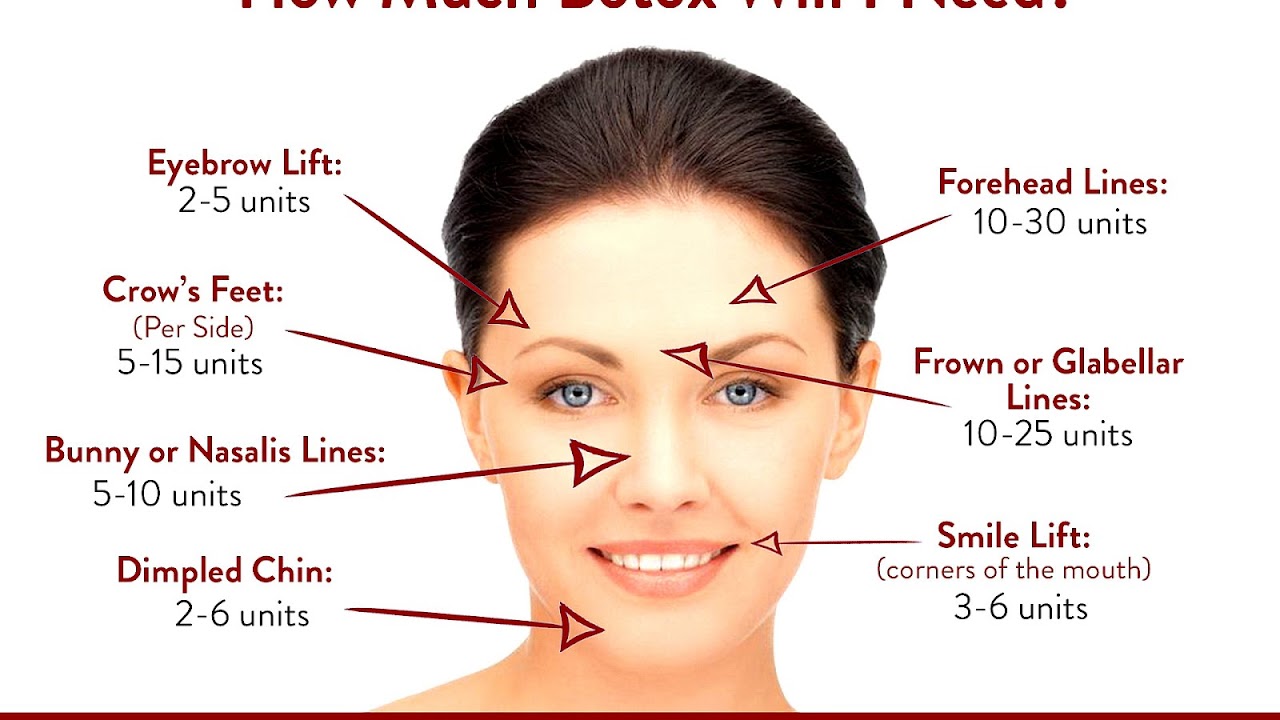How Much Does Botox Injections Cost