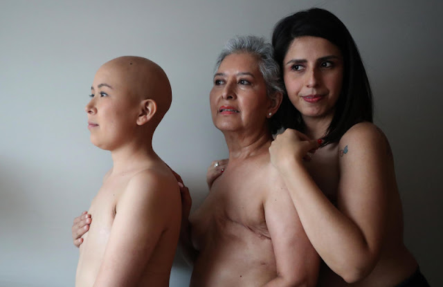 Fotografía que muestra a Lorena Estrada (i), Angeles Arreola (c) y Sandra Monrroy (d), pacientes con cáncer de mama, mientras posan en Ciudad de México (México)(EPA) EFE