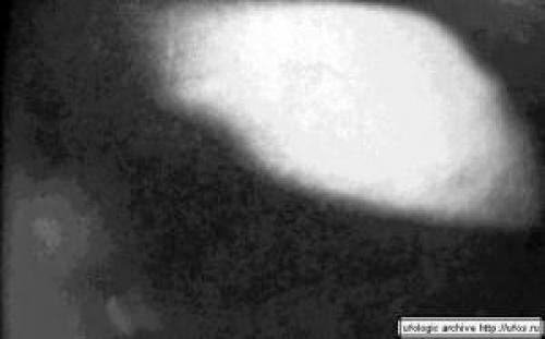 Alien Autopsy Roswell