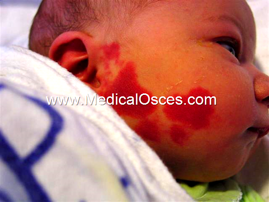 What is your Spot Diagnosis ?