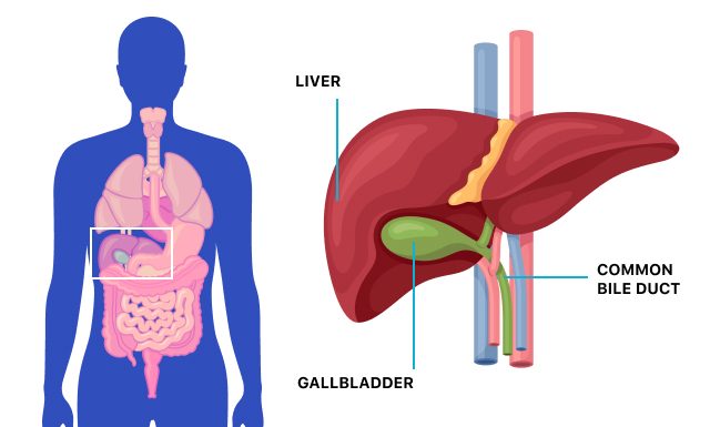 WHAT IS GALLBLADDER? CAUSES, PAIN, FUNCTION, WHAT CAUSES GALLSTONE? SYMPTOMS, CAN YOU LIVE WITHOUT IT? WHAT HAPPENED AFTER GALLBLADDER REMOVE? DIAGNOSIS. TREATMENT