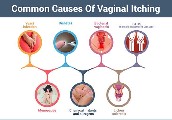 Causes Of Vaginal Itching