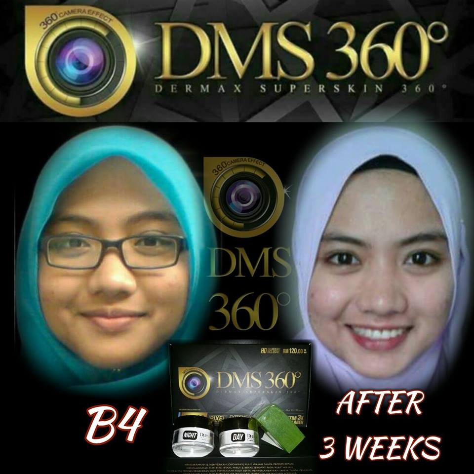 sugeh cosmetic: ♥ DMS 360- Dermax Superskin 360 CANTIK ...