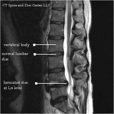 For your back, it should include observatory and palpatory findings, 