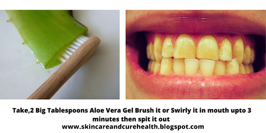 Clean your teeth using Aloe Vera Gel only