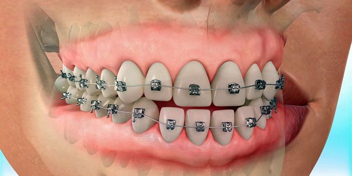 Orthodontic