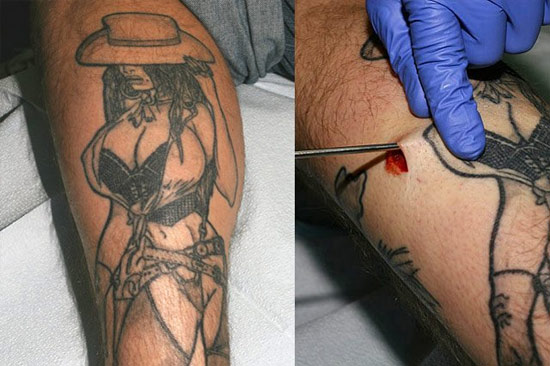 His tattoo of lady now have breast silicone implants but he got a horrible 