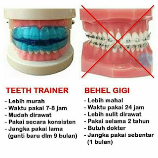 keunggulan teeth trainer