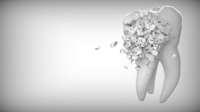 نصائح مفيدة وفعالة للوقاية من تسوس الأسنان المزعج لدى الجميع